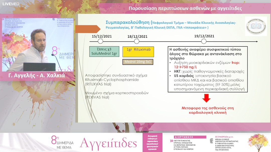 23 Γ. Αγγελής - Α. Χαλκιά - Παρουσίαση περιπτώσεων ασθενών με αγγειίτιδες