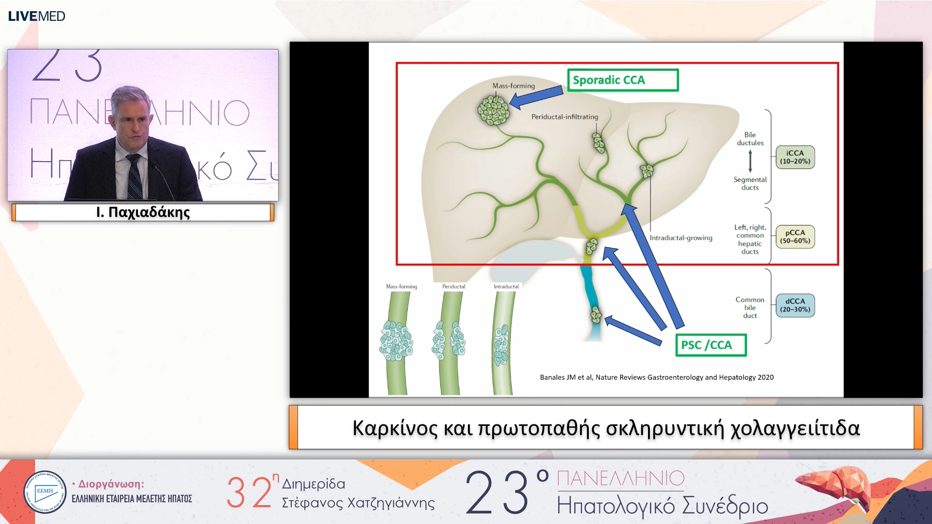 090 Ι. Παχιαδάκης - Καρκίνος και πρωτοπαθής σκληρυντική χολαγγειίτιδα