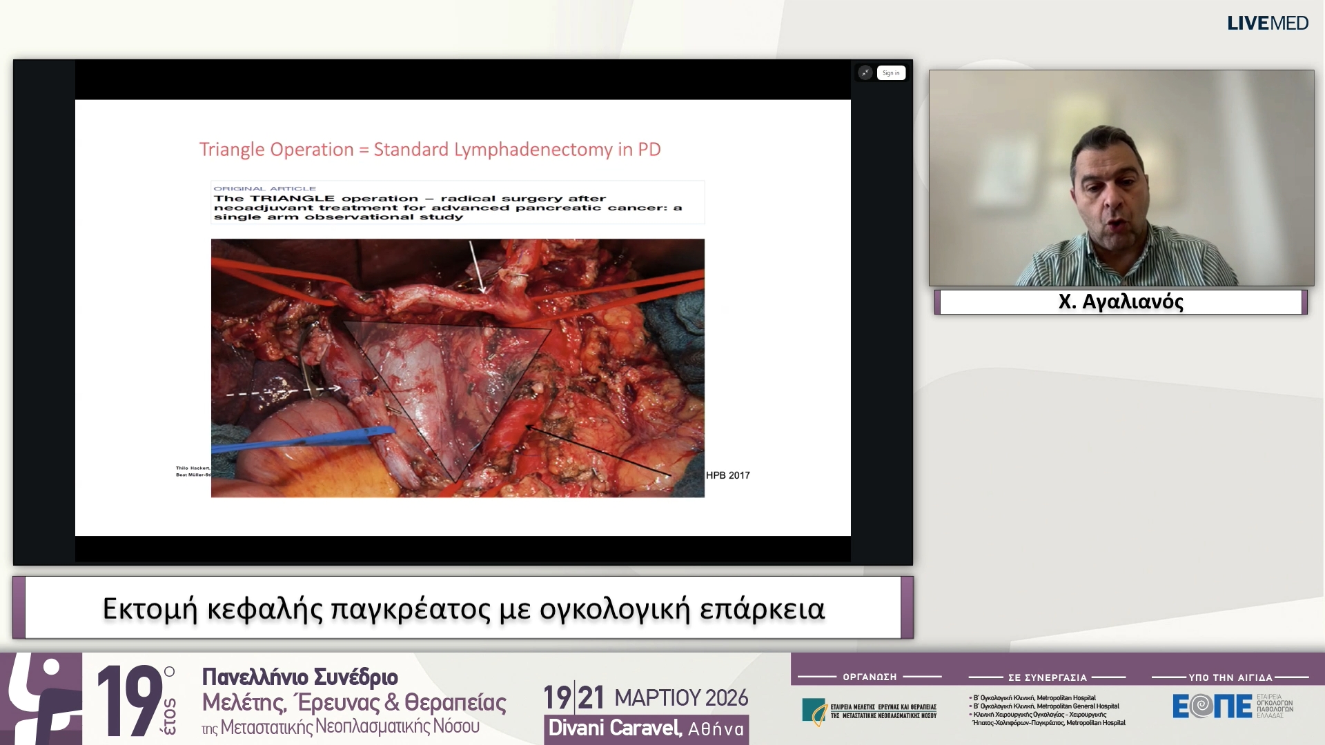 21 Χ. Αγαλιανός - Εκτομή κεφαλής παγκρέατος με ογκολογική επάρκεια