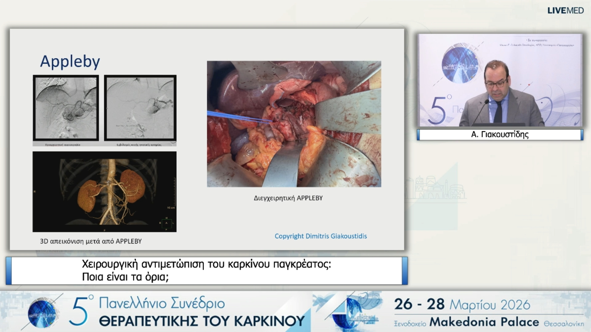 23 Α. Γιακουστίδης - Χειρουργική αντιμετώπιση του καρκίνου παγκρέατος: Ποια είναι τα όρια; 