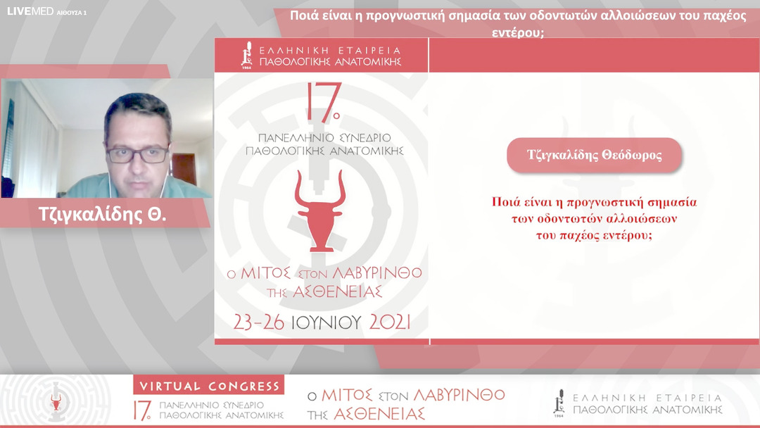 38 Τζιγκαλίδης Θ. - Ποιά είναι η προγνωστική σημασία των οδοντωτών αλλοιώσεων του παχέος εντέρου;