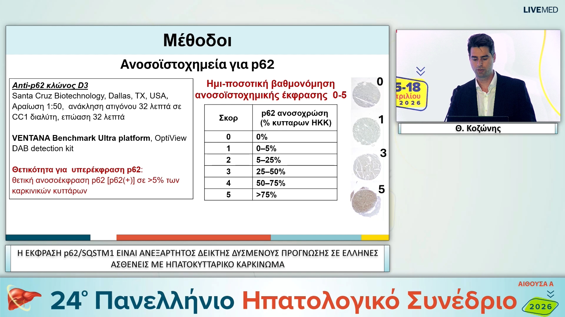 070 Θ. Κοζώνης - ΕΑ17 Η ΕΚΦΡΑΣΗ p62/SQSTM1 ΕΙΝΑΙ ΑΝΕΞΑΡΤΗΤΟΣ ΔΕΙΚΤΗΣ ΔΥΣΜΕΝΟΥΣ ΠΡΟΓΝΩΣΗΣ ΣΕ ΕΛΛΗΝΕΣ ΑΣΘΕΝΕΙΣ ΜΕ ΗΠΑΤΟΚΥΤΤΑΡΙΚΟ ΚΑΡΚΙΝΩΜΑ