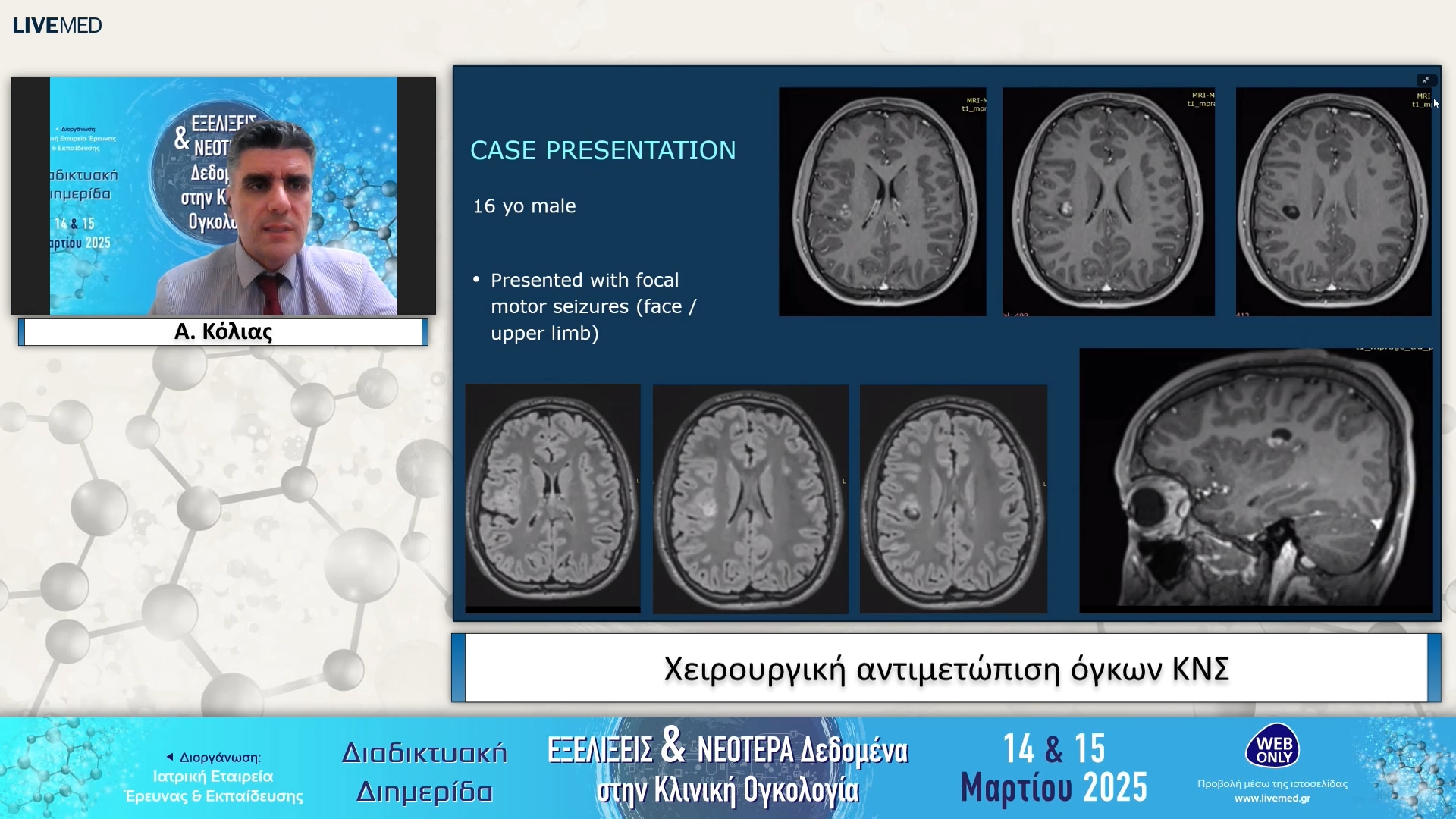 15 Α. Κόλιας - Χειρουργική αντιμετώπιση όγκων ΚΝΣ 