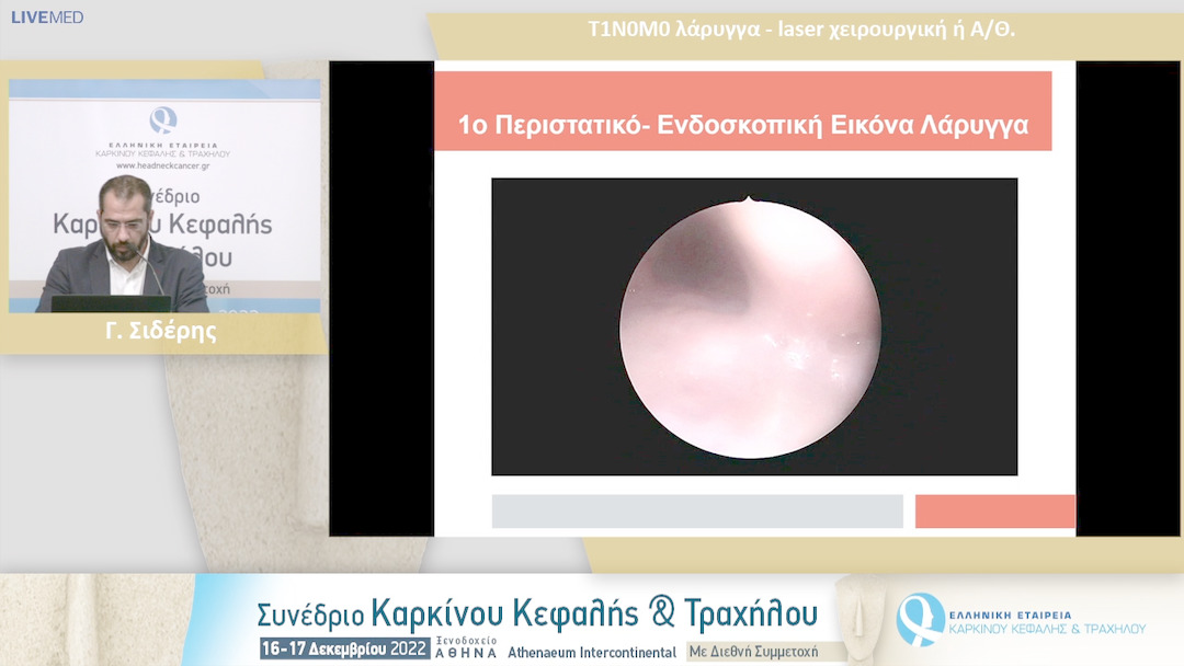 21 Γ. Σιδέρης - Τ1Ν0Μ0 λάρυγγα - laser χειρουργική ή Α/Θ.