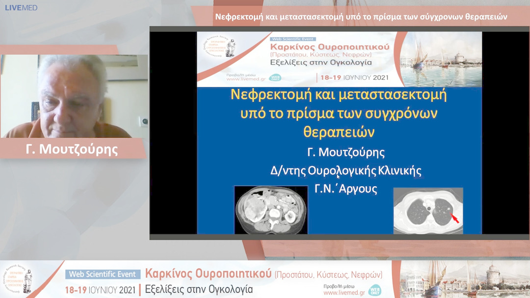 34 Γ. Μουτζούρης - Νεφρεκτομή και μεταστασεκτομή υπό το πρίσμα των σύγχρονων θεραπειών 