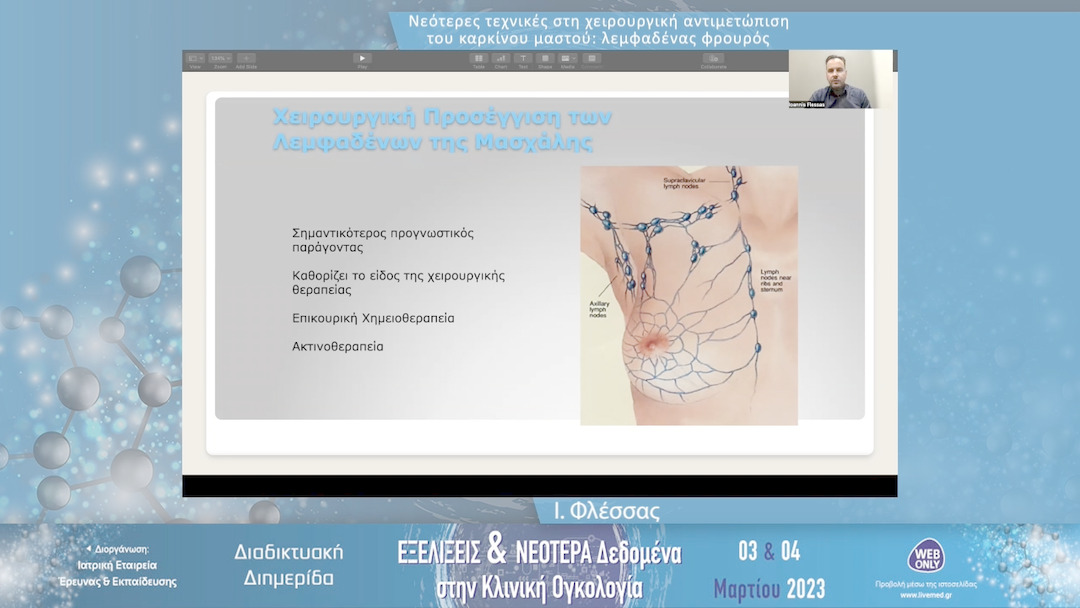 23 Ι. Φλέσσας - Νεότερες τεχνικές στη χειρουργική αντιμετώπιση του καρκίνου μαστού: λεμφαδένας φρουρός