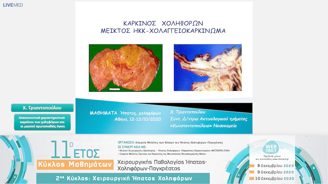 10 Χ. Τριαντοπούλου - Απεικονιστικά χαρακτηριστικά καρκίνου των χοληφόρων και οι μεικτοί πρωτοπαθείς όγκοι