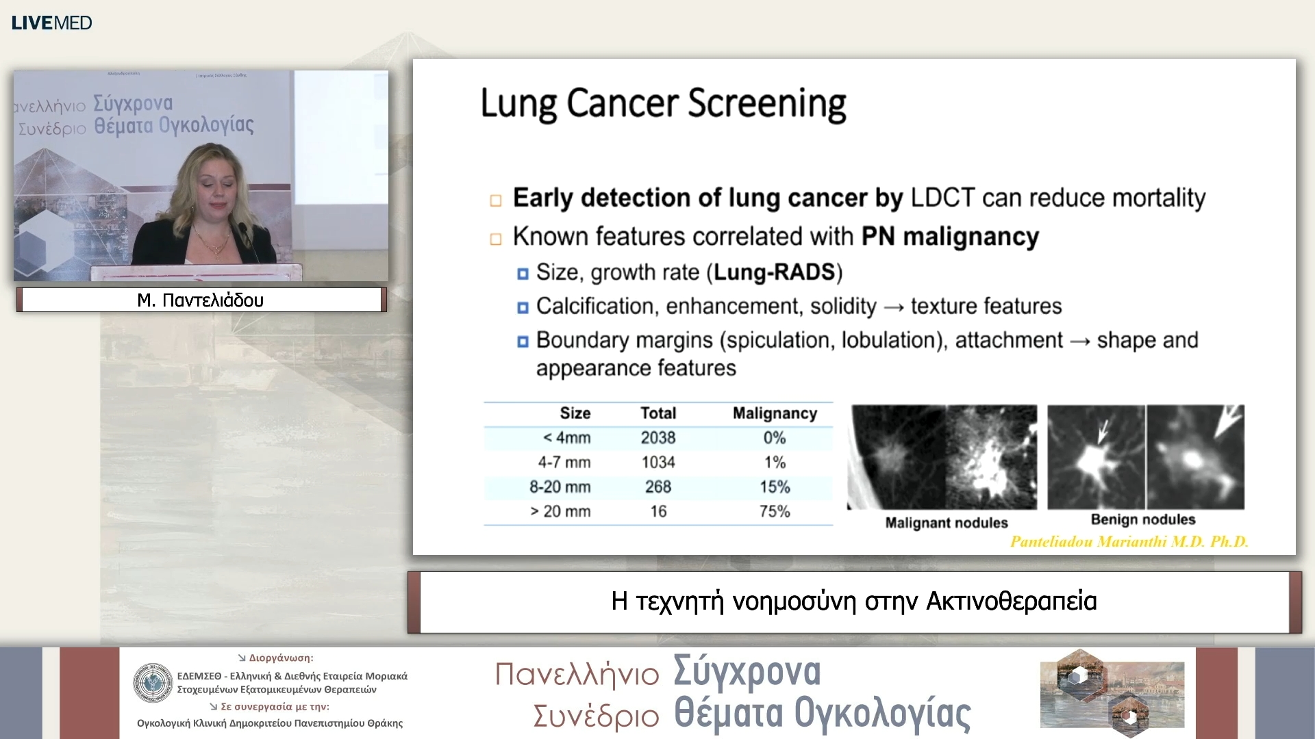 18 Μ. Παντελιάδου - Η τεχνητή νοημοσύνη στην Ακτινοθεραπεία 