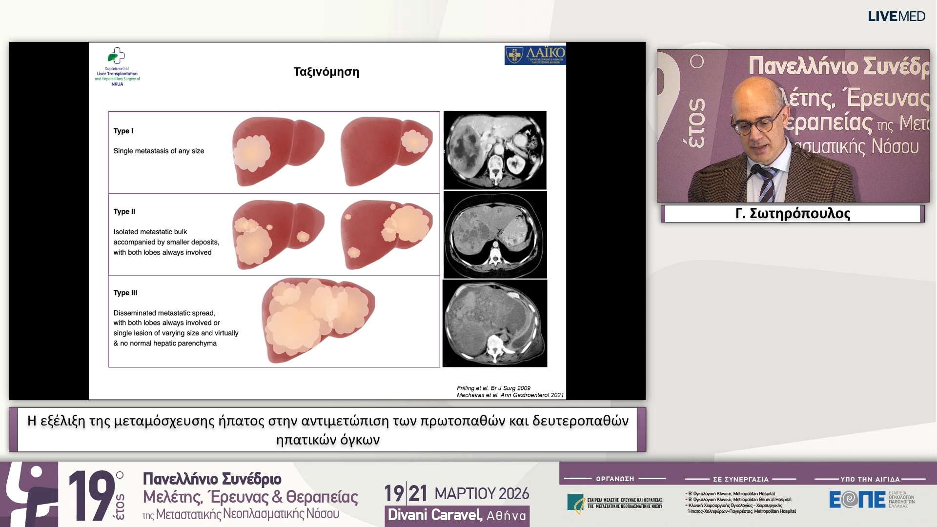 11 Γ. Σωτηρόπουλος - Η εξέλιξη της μεταμόσχευσης ήπατος στην αντιμετώπιση των πρωτοπαθών και δευτεροπαθών ηπατικών όγκων