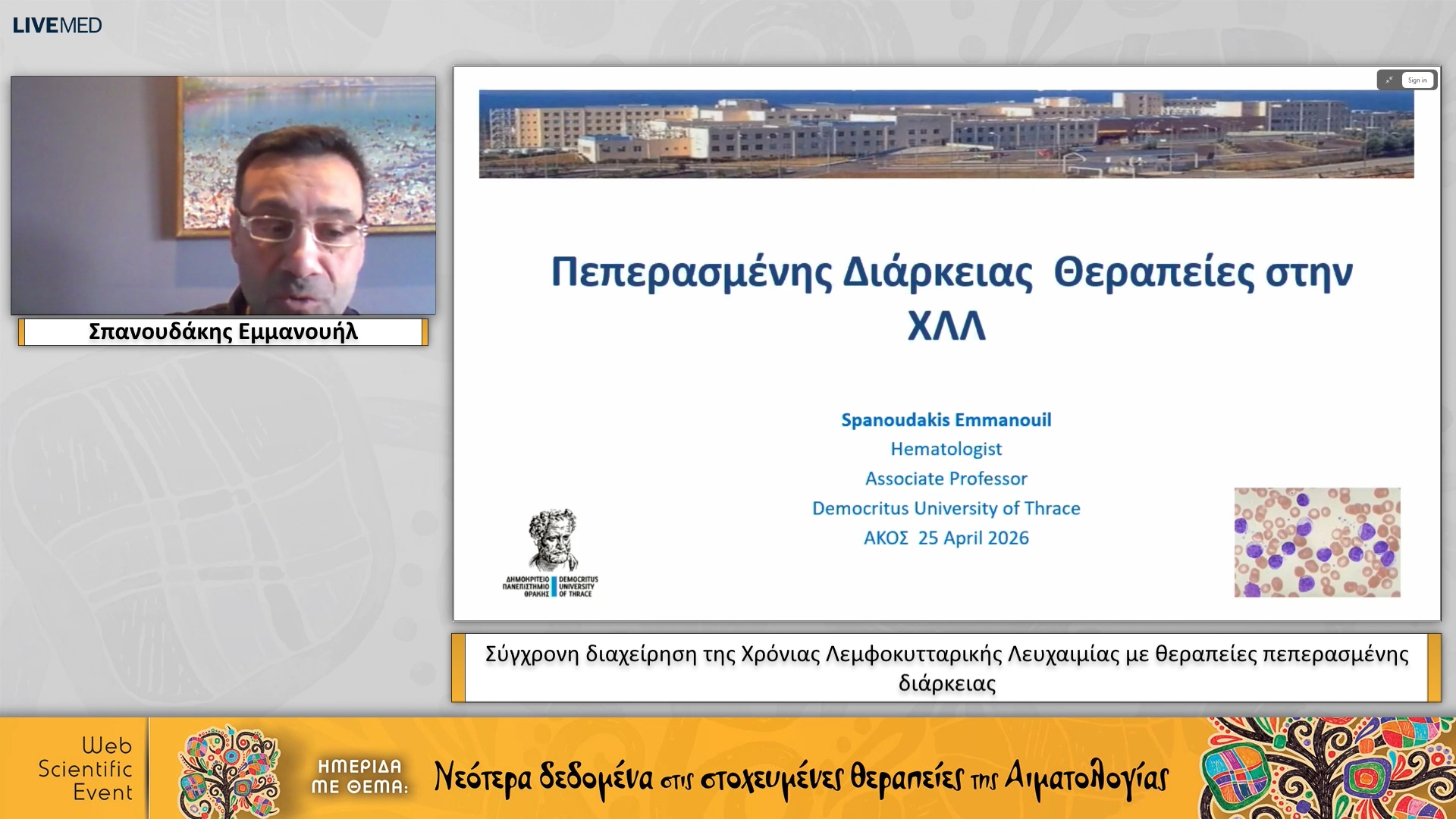 05 Σπανουδάκης Εμμανουήλ - Σύγχρονη διαχείρηση της Χρόνιας Λεμφοκυτταρικής Λευχαιμίας με θεραπείες πεπερασμένης διάρκειας