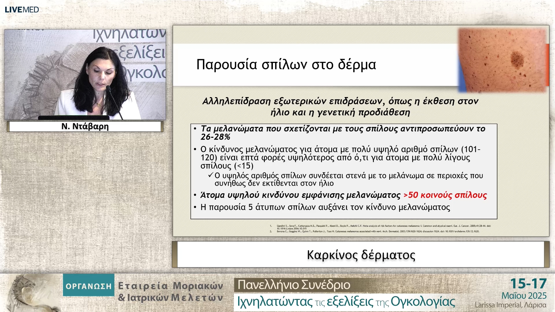 13 Ν. Ντάβαρη - Καρκίνος δέρματος