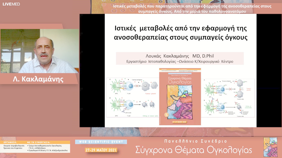 07 Λ. Κακλαμάνης - Ιστικές μεταβολές που παρατηρούνται από την εφαρμογή της ανοσοθεραπείας στους συμπαγείς όγκους, από την πλευρά του παθολογοανατόμου