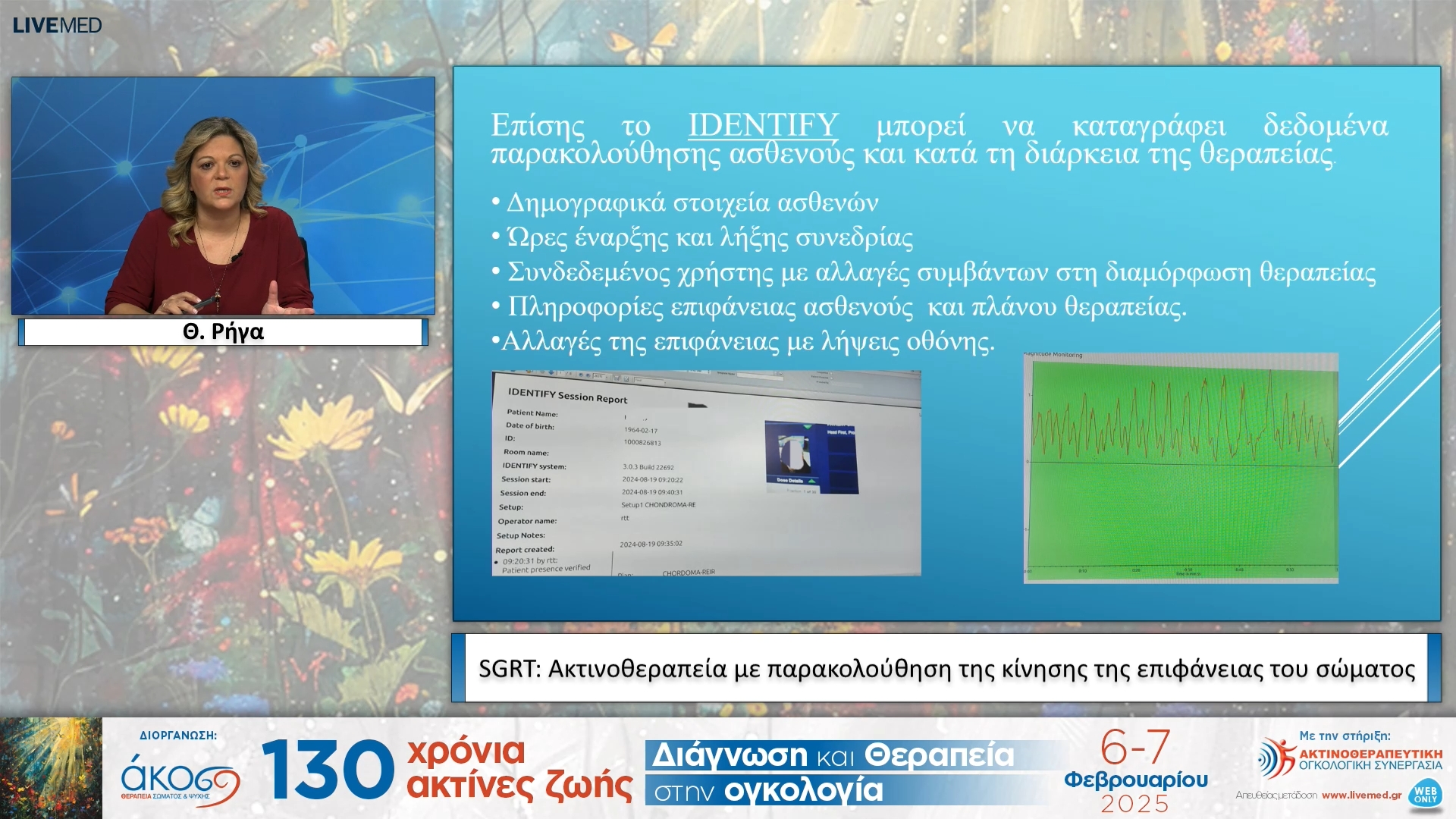 50  Θ. Ρήγα - SGRT: Ακτινοθεραπεία με παρακολούθηση της κίνησης της επιφάνειας του σώματος