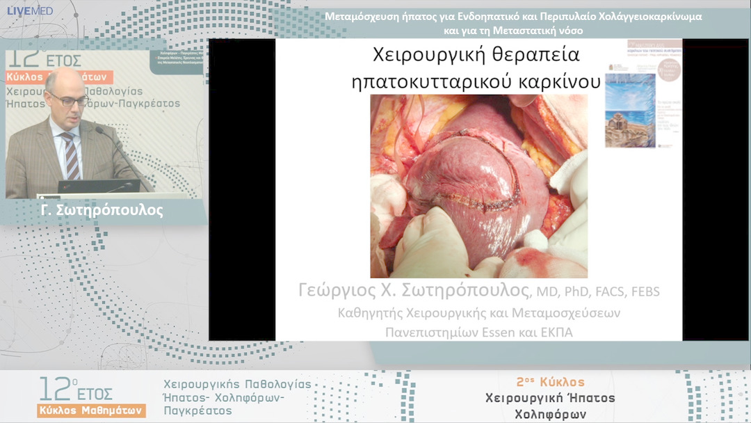 19 Γ. Σωτηρόπουλος - Μεταμόσχευση ήπατος για Ενδοηπατικό και Περιπυλαίο Χολάγγειοκαρκίνωμα και για τη Μεταστατική νόσο
