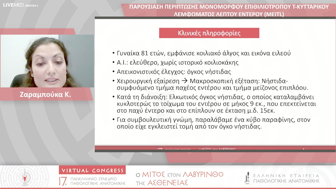 85 Ζαραμπούκα Κ. - ΠΑΡΟΥΣΙΑΣΗ ΠΕΡΙΠΤΩΣΗΣ ΜΟΝΟΜΟΡΦΟΥ ΕΠΙΘΙΛΙΟΤΡΟΠΟΥ Τ-ΚΥΤΤΑΡΙΚΟΥ ΛΕΜΦΩΜΑΤΟΣ ΛΕΠΤΟΥ ΕΝΤΕΡΟΥ (MEITL)
