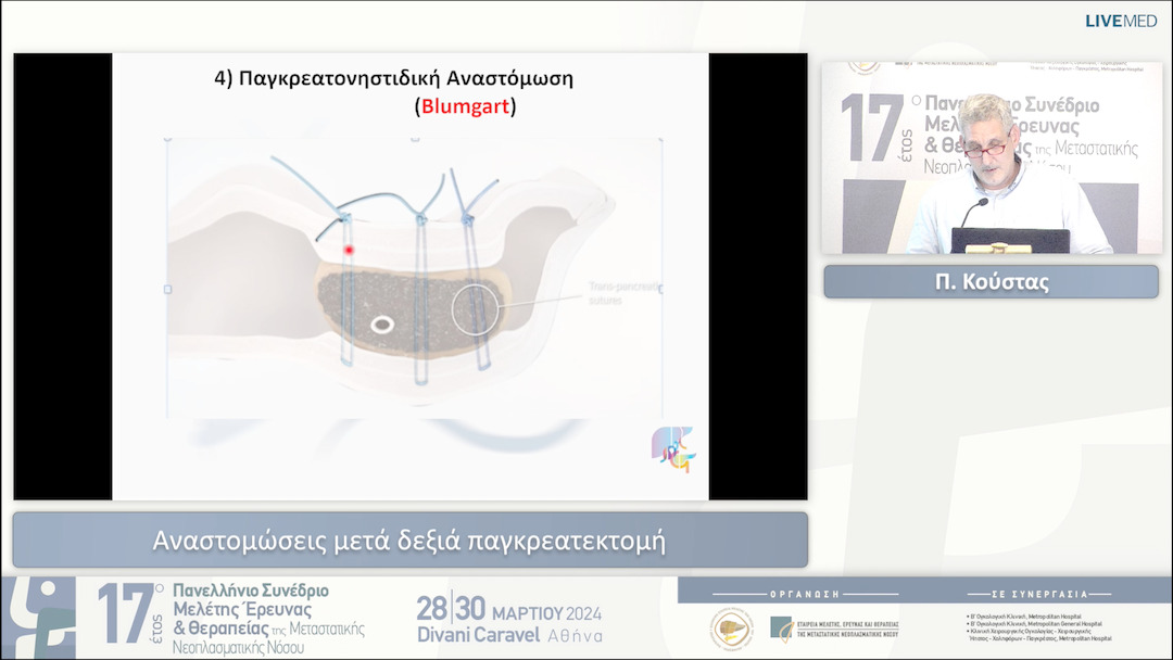 12 Π. Κούστας - Αναστομώσεις μετά δεξιά παγκρεατεκτομή 