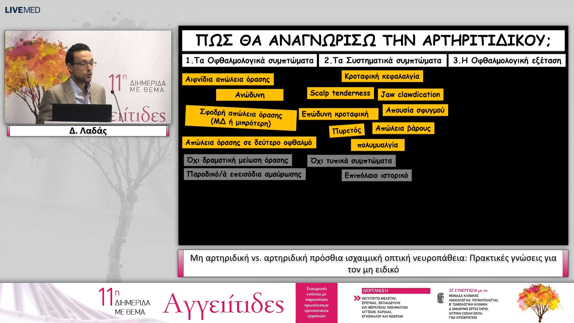 27 Δ. Λαδάς - Μη αρτηριδική vs. αρτηριδική πρόσθια ισχαιμική οπτική νευροπάθεια: Πρακτικές γνώσεις για τον μη ειδικό