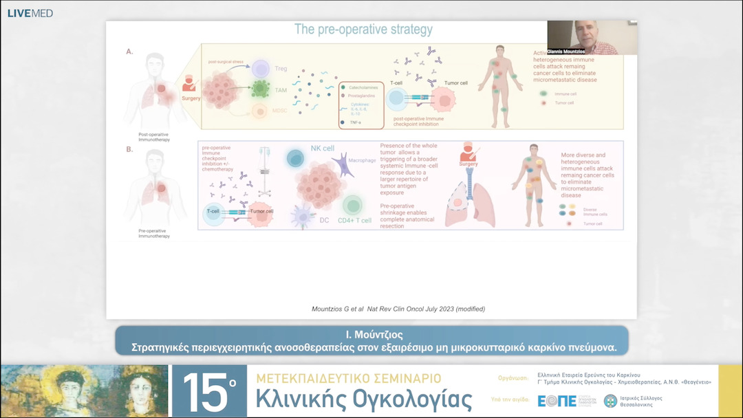 35 Ι. Μούντζιος - Στρατηγικές περιεγχειρητικής ανοσοθεραπείας στον  εξαιρέσιμο μη μικροκυτταρικό καρκίνο πνεύμονα. 