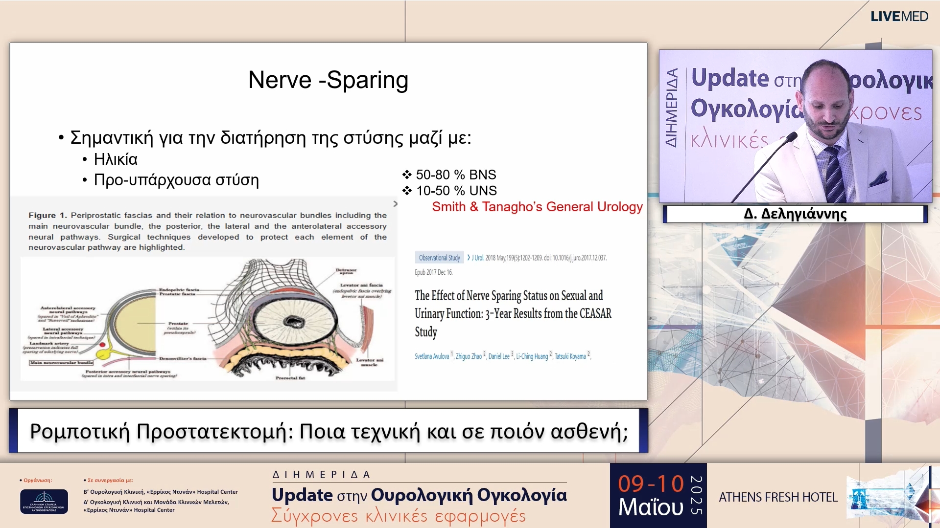 03 Δ. Δεληγιάννης - Ρομποτική Προστατεκτομή: Ποια τεχνική και σε ποιόν ασθενή; 