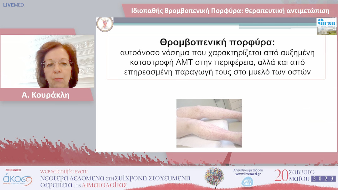 13 Αλεξάνδρα Κουράκλη - Ιδιοπαθής θρομβοπενική Πορφύρα: θεραπευτική αντιμετώπιση