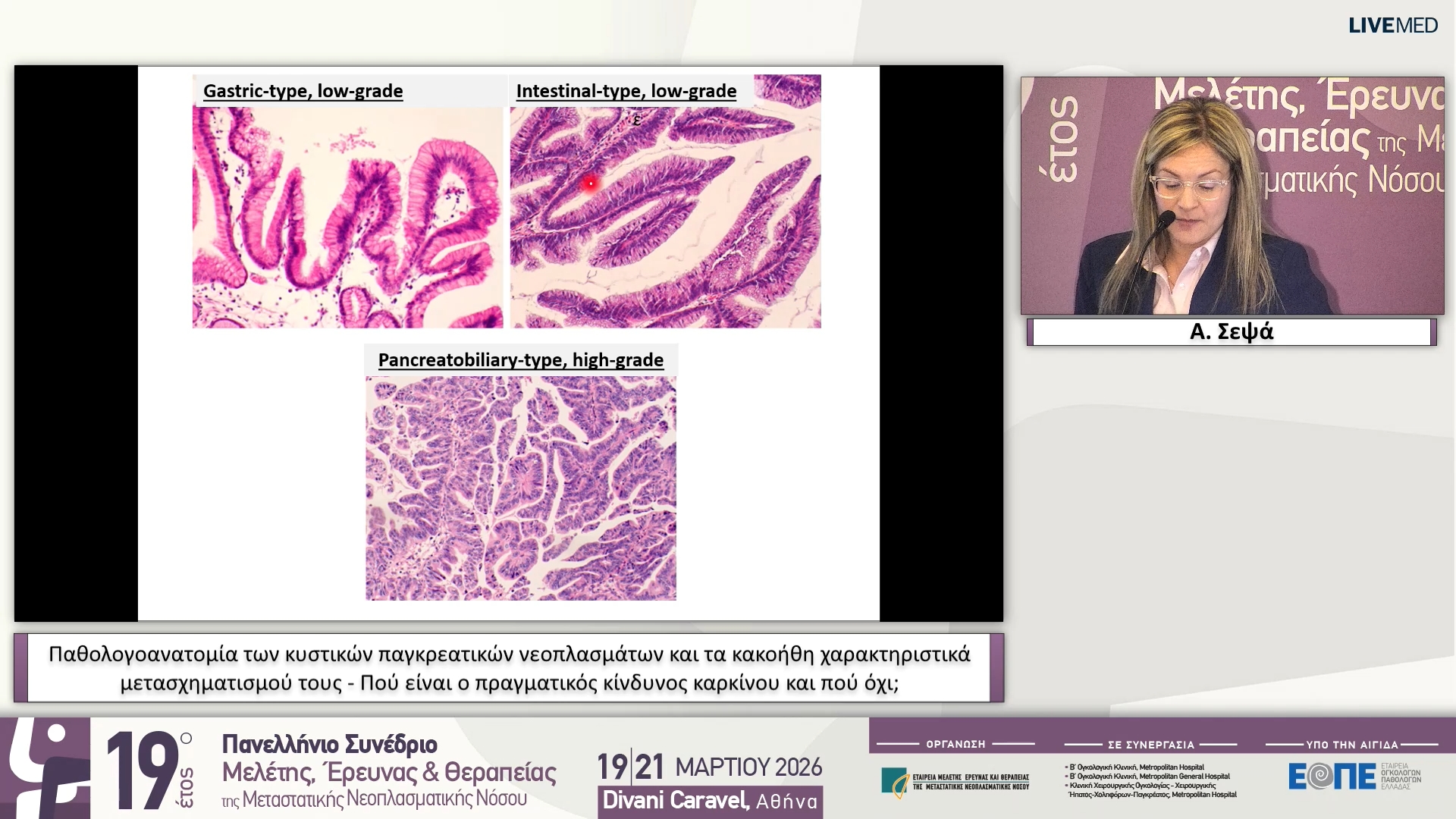 12 Α. Σεψά - Παθολογοανατομία των κυστικών παγκρεατικών νεοπλασμάτων και τα κακοήθη χαρακτηριστικά μετασχηματισμού τους - Πού είναι ο πραγματικός κίνδυνος καρκίνου και πού όχι;