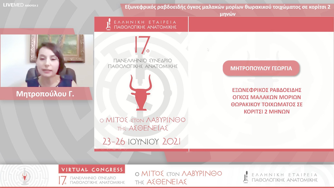 32 Μητροπούλου Γ. - Εξωνεφρικός ραβδοειδής όγκος μαλακών μορίων θωρακικού τοιχώματος σε κορίτσι 2 μηνών 