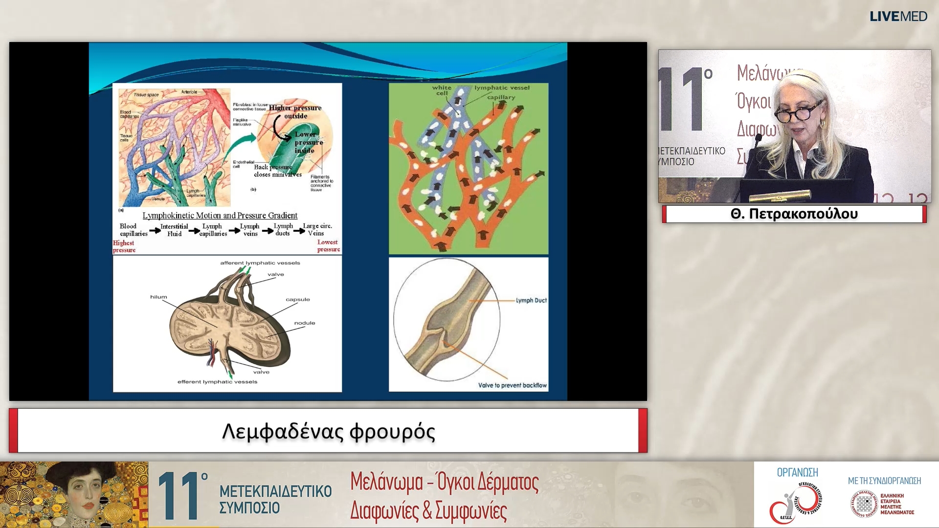 10 Θ. Πετρακοπούλου - Λεμφαδένας φρουρός