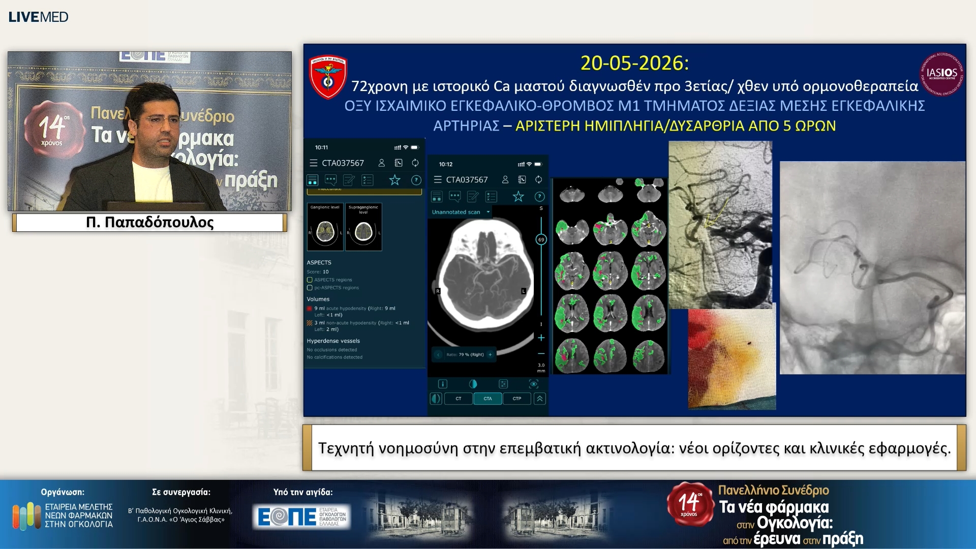 29 Π. Παπαδόπουλος - Τεχνητή νοημοσύνη στην επεμβατική ακτινολογία: νέοι ορίζοντες και κλινικές εφαρμογές. 