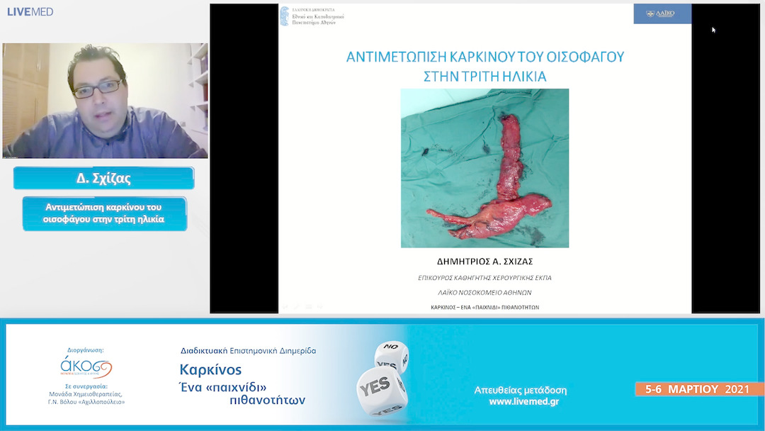 27 Δ. Σχίζας - Αντιμετώπιση καρκίνου του οισοφάγου στην τρίτη ηλικία. 