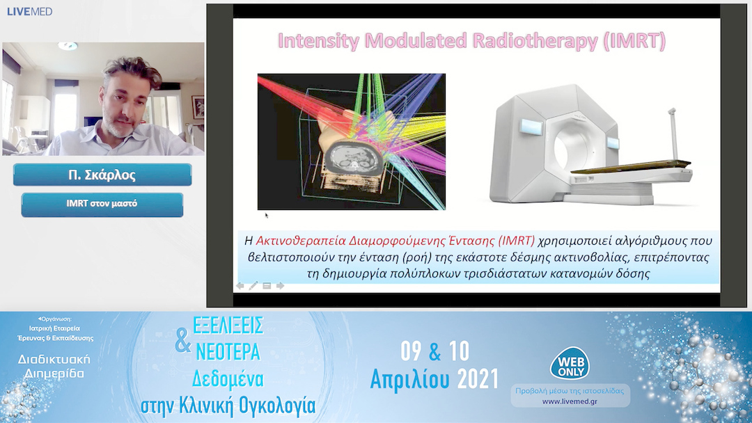 26 Π. Σκάρλος - IMRT στον μαστό