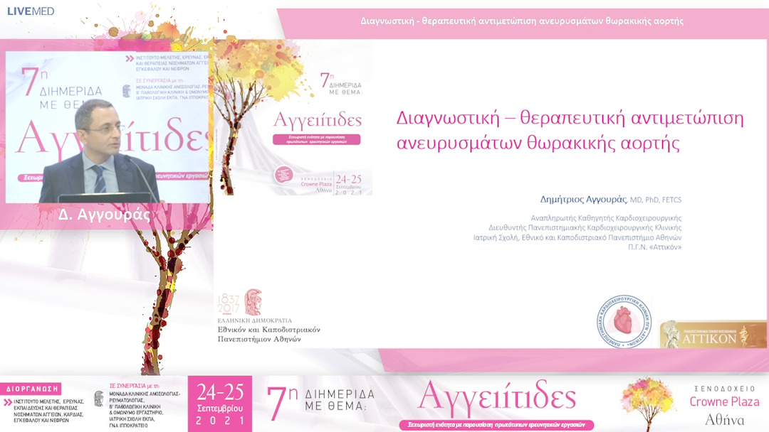 22 Δ. Αγγουράς - Διαγνωστική - θεραπευτική αντιμετώπιση ανευρυσμάτων θωρακικής αορτής