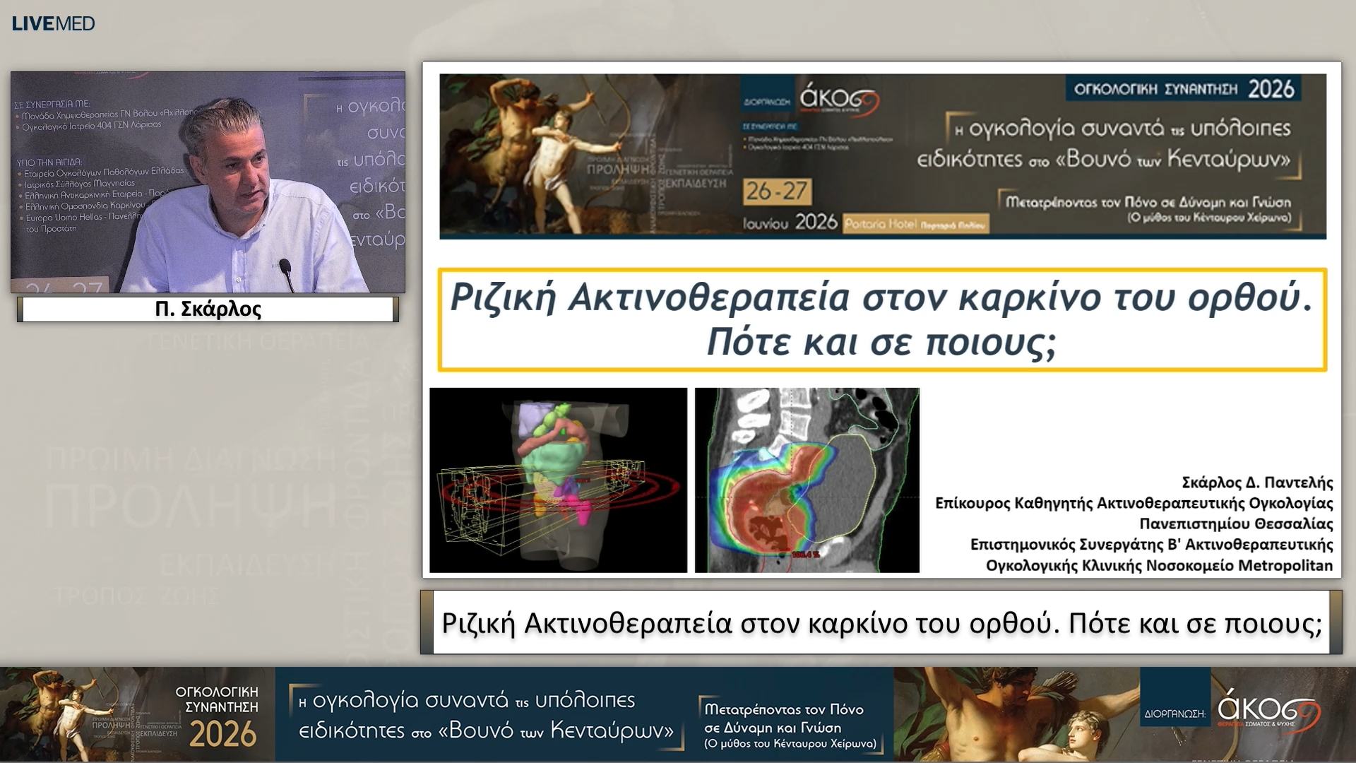 34 Π. Σκάρλος - Ριζική Ακτινοθεραπεία στον καρκίνο του ορθού. Πότε και σε ποιους; 