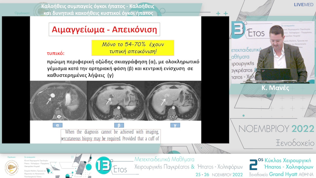 06  Κ. Μανές - Καλοήθεις συμπαγείς όγκοι ήπατος - Καλοήθεις και δυνητικά κακοήθεις κυστικοί όγκοι ήπατος