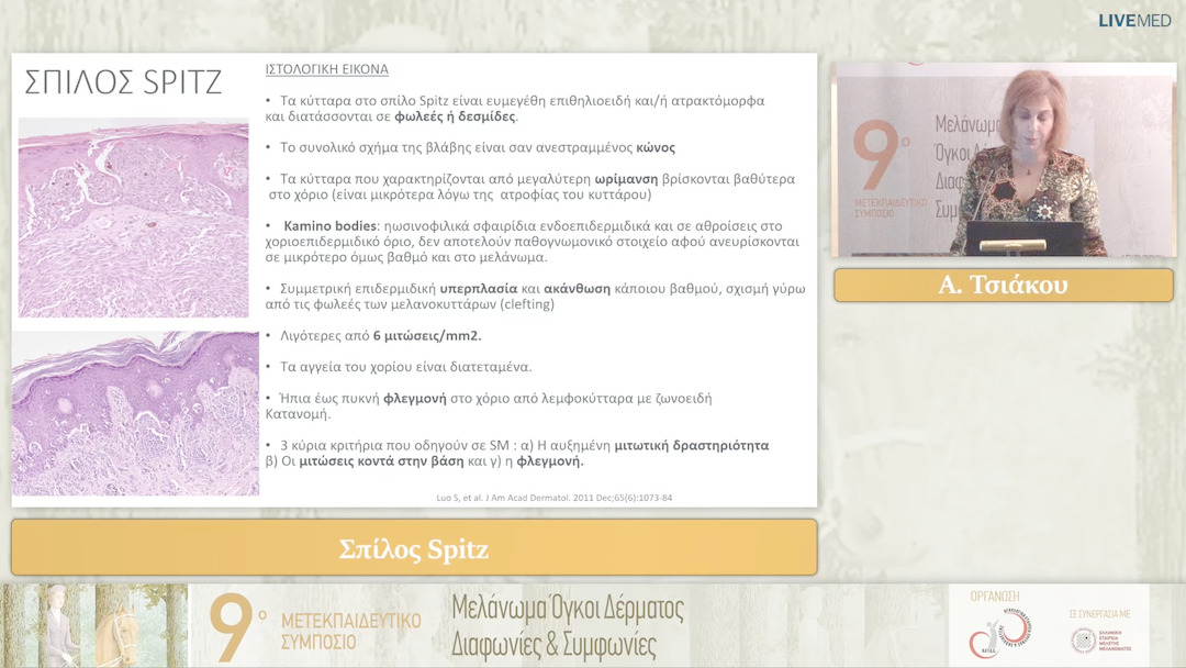 18 Α. Τσιάκου - Σπίλος Spitz 