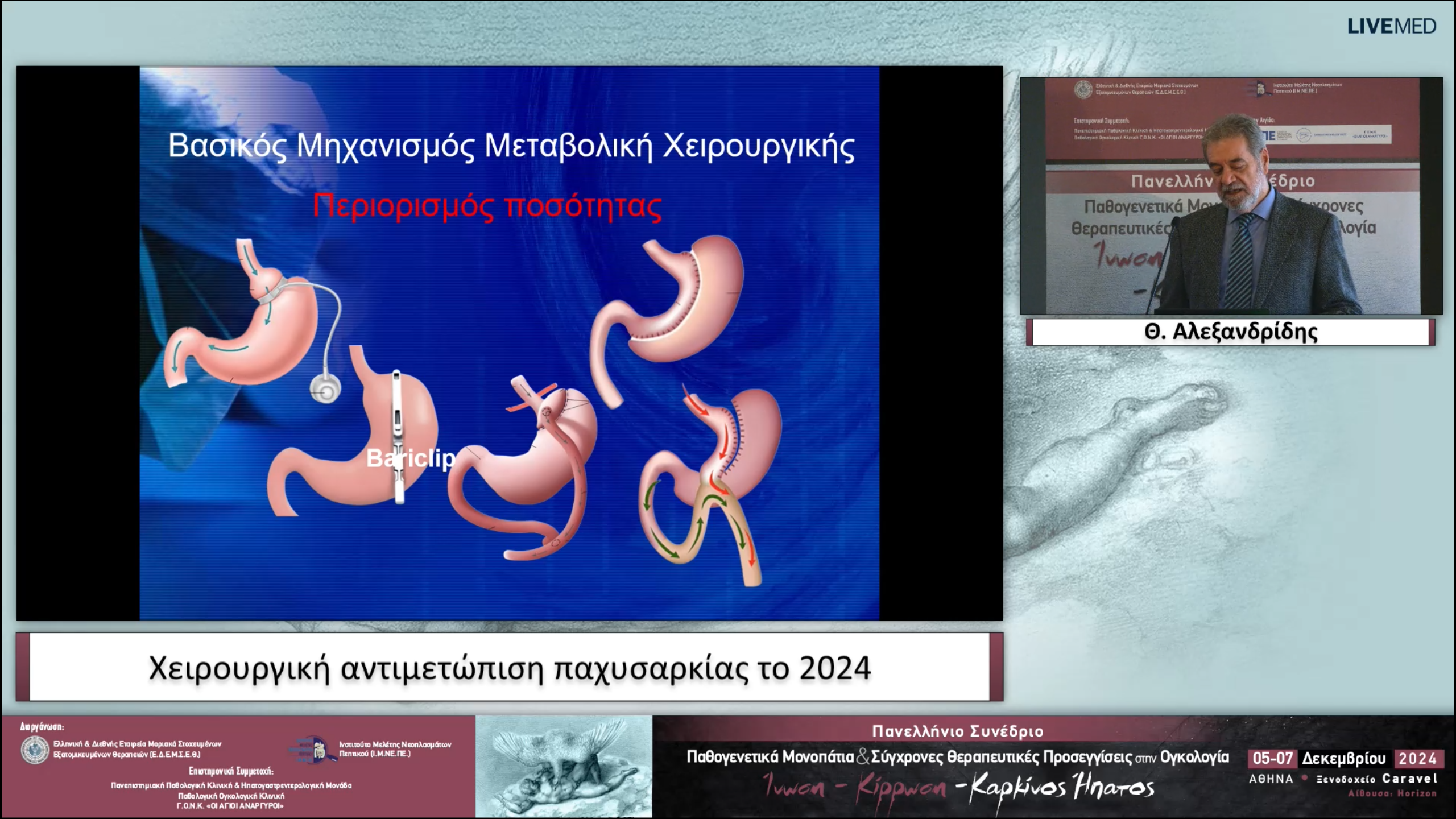 11 Θ. Αλεξανδρίδης - Χειρουργική αντιμετώπιση παχυσαρκίας το 2024