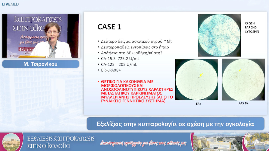 20 Μ. Τσιρονίκου - Εξελίξεις στην κυτταρολογία σε σχέση με την ογκολογία