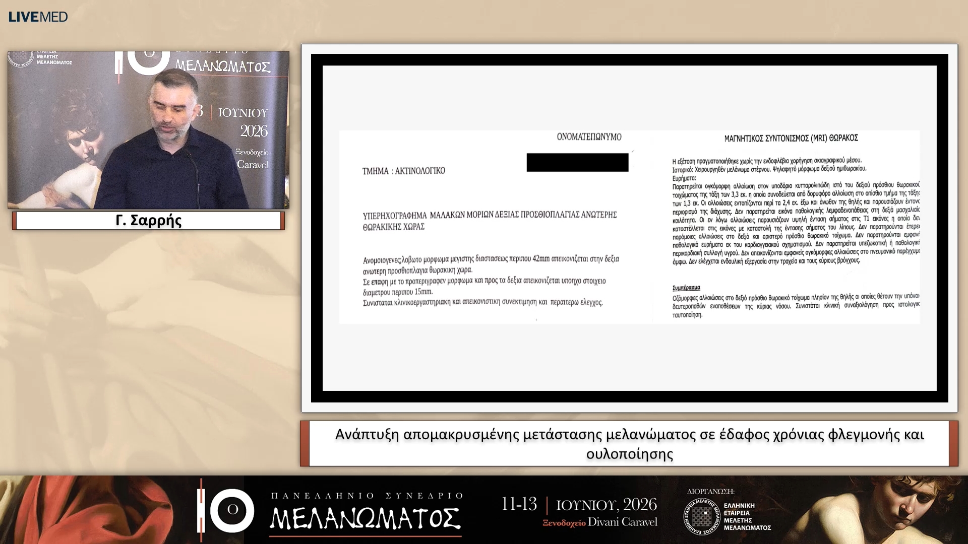 26 ΕΑ03 Ανάπτυξη απομακρυσμένης μετάστασης μελανώματος σε έδαφος χρόνιας φλεγμονής και ουλοποίησης 