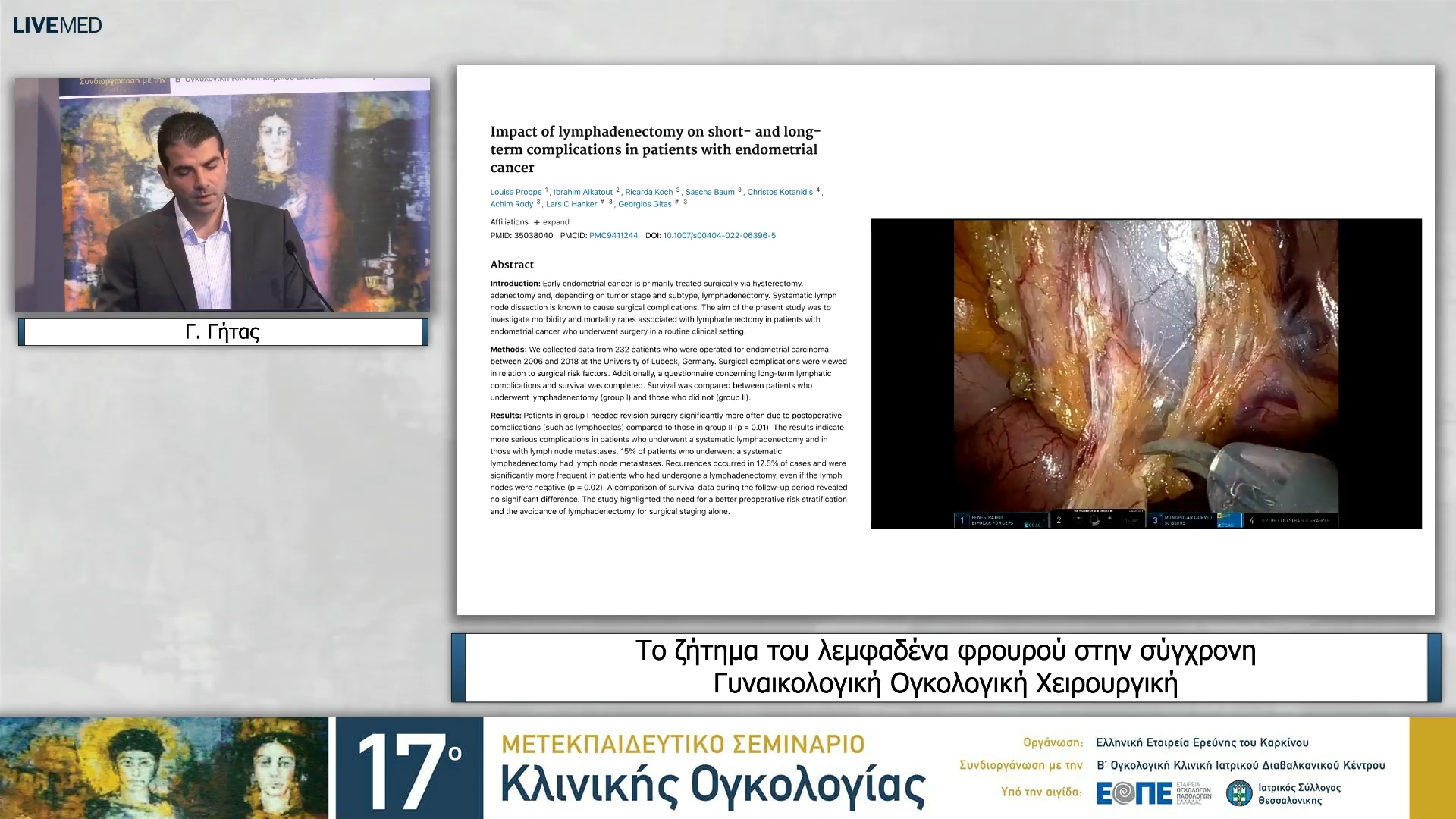 13 Γ. Γήτας - Το ζήτημα του λεμφαδένα φρουρού στην σύγχρονη Γυναικολογική Ογκολογική Χειρουργική