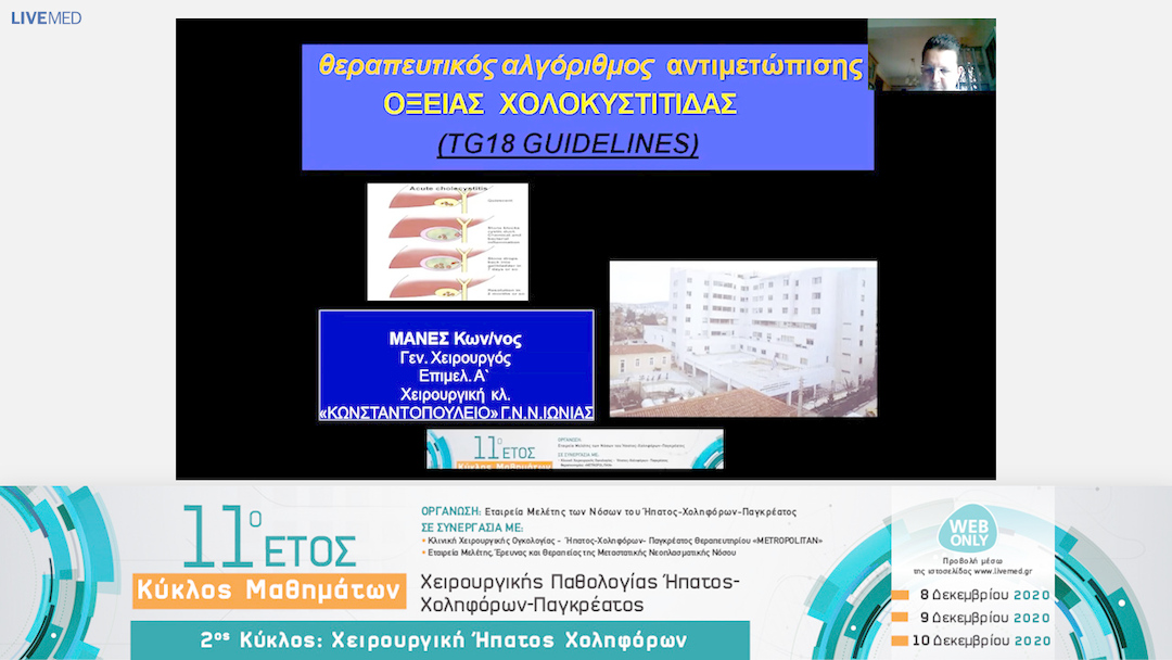 01 Κ. Μανές - Αλγόριθμος αντιμετώπισης Οξείας Χολοκυστίτιδας