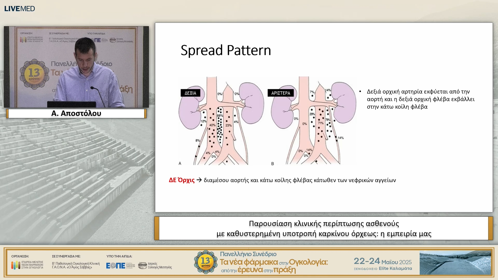 22 Α. Αποστόλου - Παρουσίαση κλινικής περίπτωσης ασθενούς με καθυστερημένη υποτροπή καρκίνου όρχεως: η εμπειρία μας. 