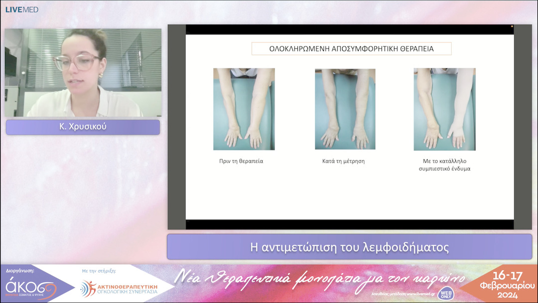 35 Κ. Χρυσικού - Η αντιμετώπιση του λεμφοιδήματος 