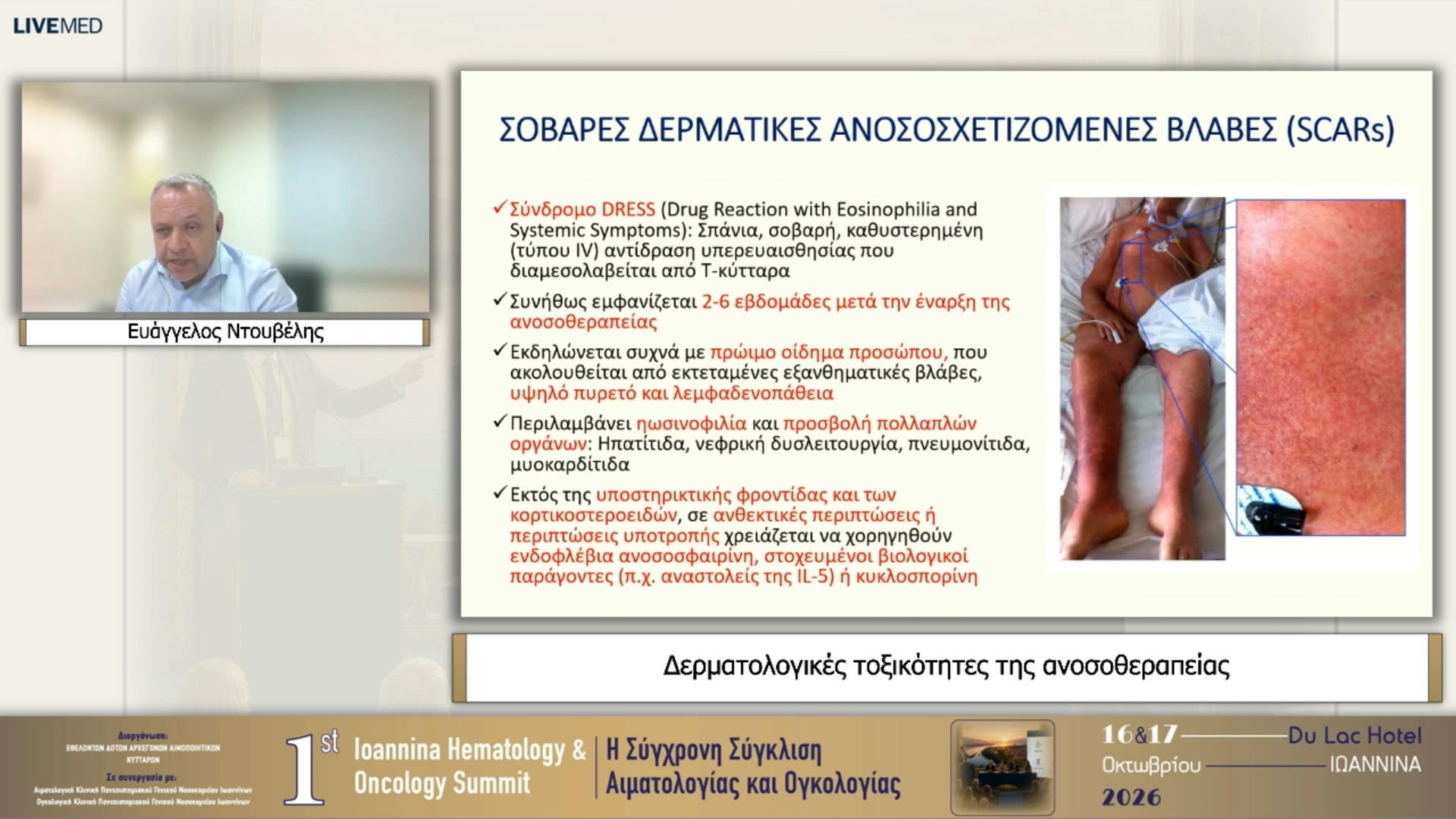 22 Ευάγγελος Ντουβέλης - Δερματολογικές τοξικότητες της ανοσοθεραπείας