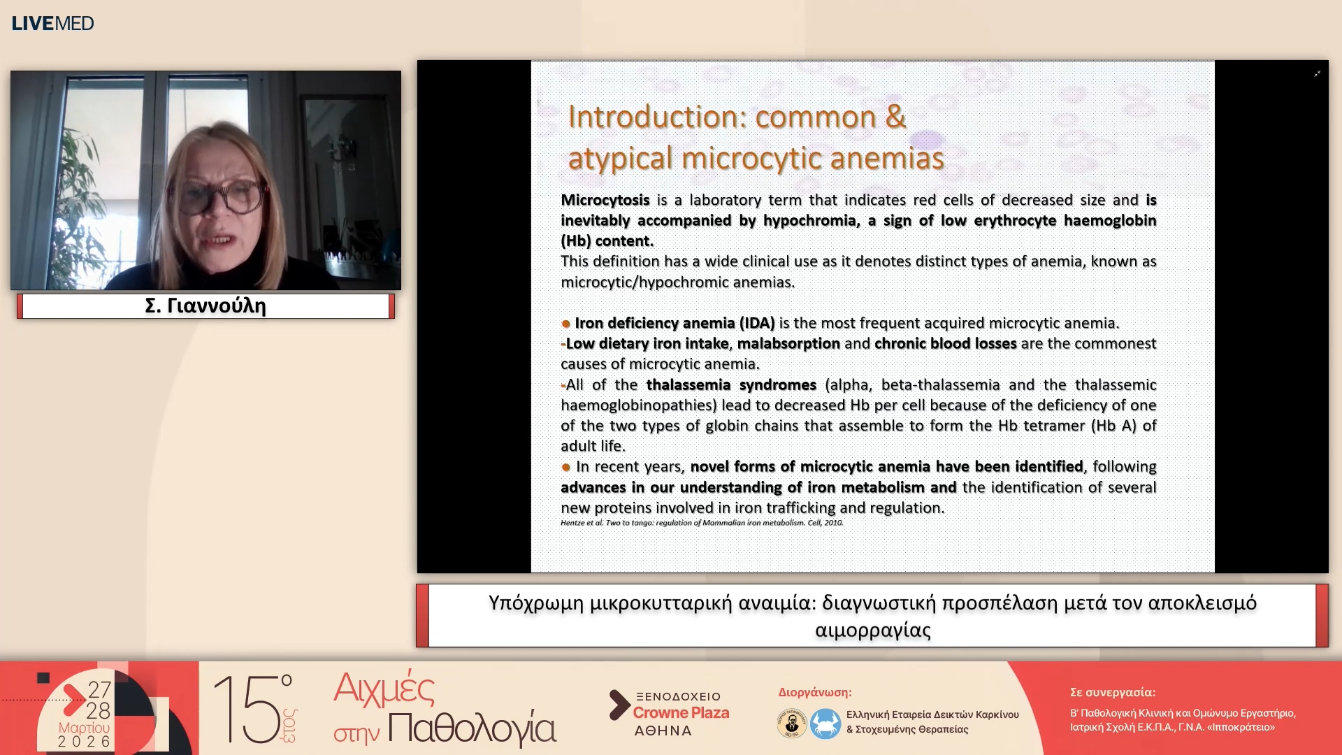 42 Σ. Γιαννούλη - Yπόχρωμη μικροκυτταρική αναιμία: διαγνωστική προσπέλαση μετά τον αποκλεισμό αιμορραγίας