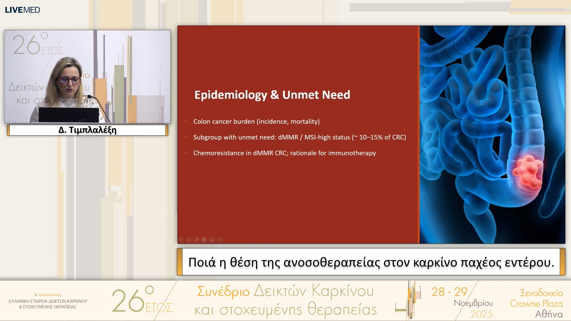 40 Δ. Τιμπλαλέξη - Ποιά η θέση της ανοσοθεραπείας στον καρκίνο παχέος εντέρου.