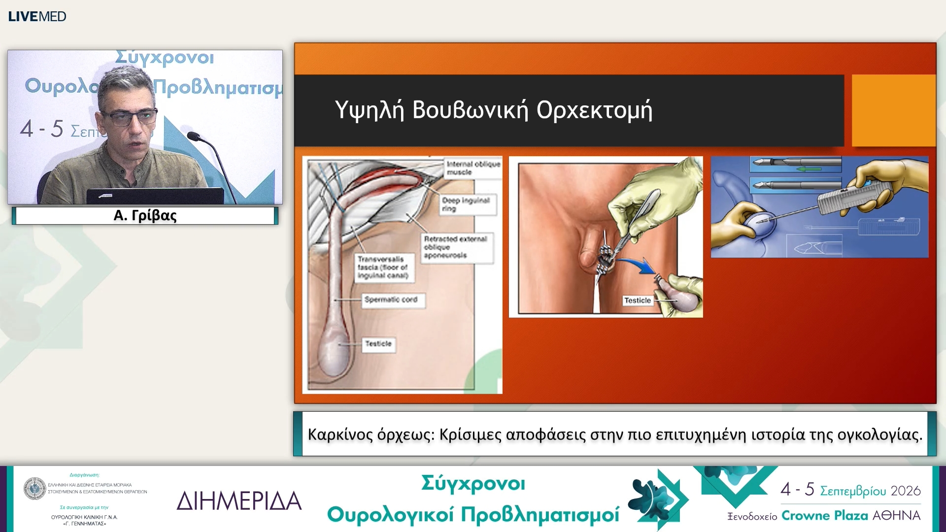 25 Α. Γρίβας - Καρκίνος όρχεως: Κρίσιμες αποφάσεις στην πιο επιτυχημένη ιστορία της ογκολογίας. 