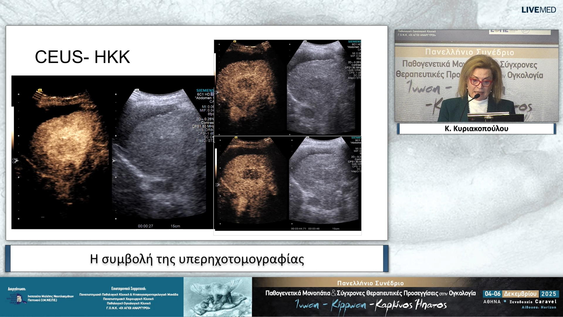 36 Κ. Κυριακοπούλου - Η συμβολή της υπερηχοτομογραφίας