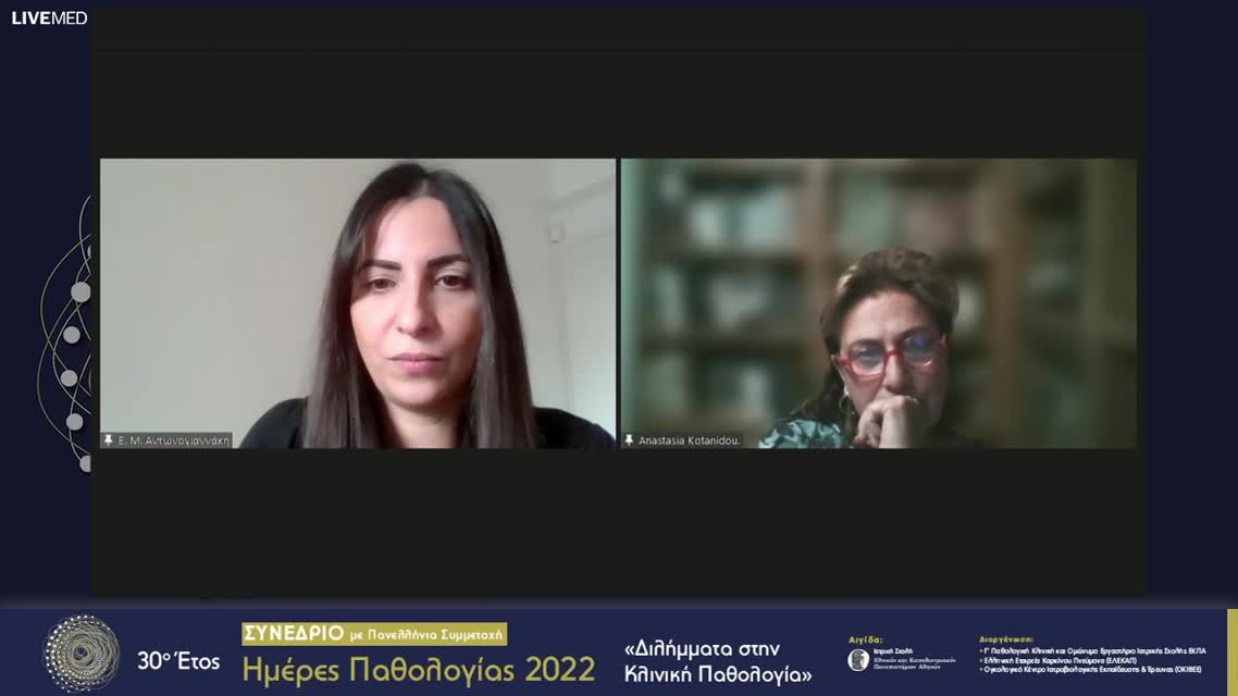69 Συζήτηση