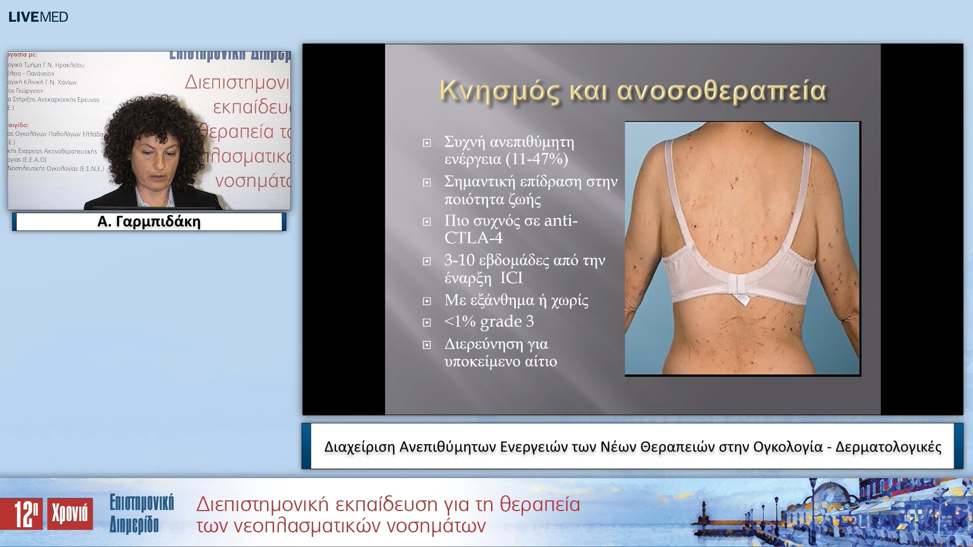 45 Α. Γαρμπιδάκη - Διαχείριση Ανεπιθύμητων Ενεργειών των Νέων Θεραπειών στην Ογκολογία - Δερματολογικές