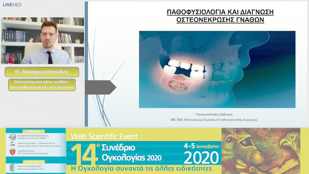 10 Θ. Παναγιωτόπουλος - Οστεονέκρωση κάτω γνάθου: αιτιοπαθογένεια και αντιμετώπιση