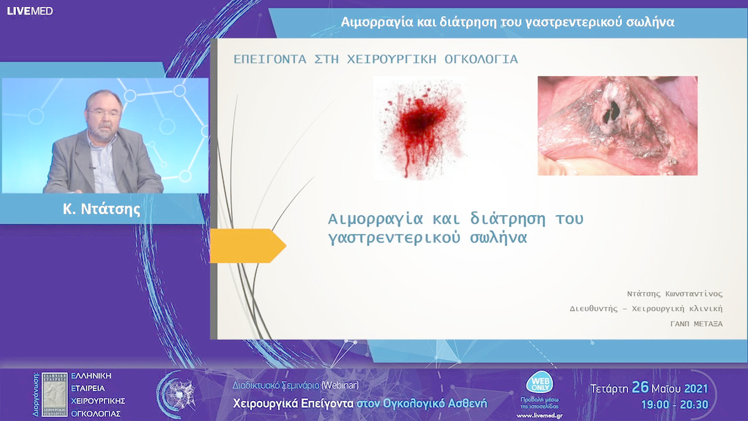02 Κ. Ντάτσης - Αιμορραγία και διάτρηση του γαστρεντερικού σωλήνα